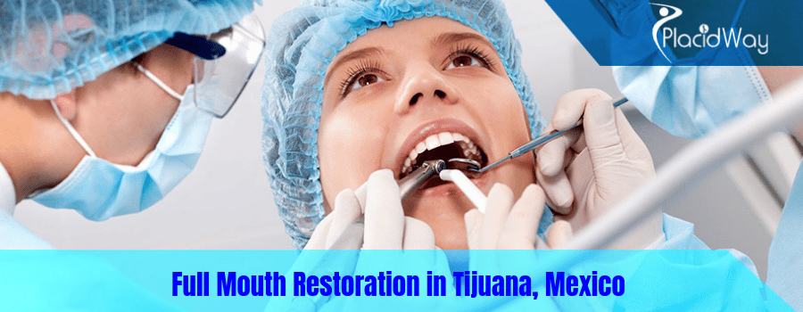 Full Mouth Restoration in Tijuana, Mexico